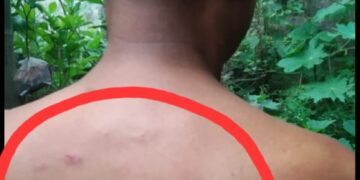 ସୂଚନା ଅଧିକାର କର୍ମୀଙ୍କୁ ବ୍ଲକ୍ ପରିସରରେ ମରଣାନ୍ତକ ଆକ୍ରମଣ