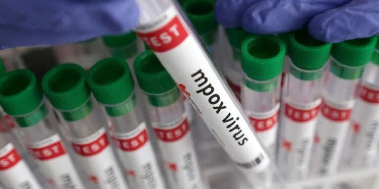 ଭାରତରେ ଏମ୍ପକ୍ସ ରୋଗୀ ଚିହ୍ନଟ: ଆଇସୋଲେସନ୍ରେ ବିଦେଶ ଫେରନ୍ତା ଯୁବକ ସନ୍ଦିଗ୍ଧ ସଂକ୍ରମିତ