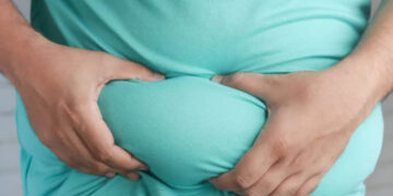 ମେଦବହୁଳତା ବିରୋଧରେ ଲଢ଼ିବା ପାଇଁ ପ୍ରଧାନମନ୍ତ୍ରୀଙ୍କ ଆହ୍ୱାନକୁ ଡାକ୍ତର ଓ କ୍ରୀଡାବିତ୍‌ଙ୍କ ସମେତ ବିଭିନ୍ନ କ୍ଷେତ୍ରରୁ ସମର୍ଥନ