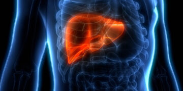 ମଦ୍ୟପାନ କରୁନଥିବା ଲୋକଙ୍କୁ ମଧ୍ୟ ହୋଇପାରେ ଫ୍ୟାଟି ଲିଭର ରୋଗ, ଜାଣନ୍ତୁ ଏହି ୪ ଟି ସଂକେତ